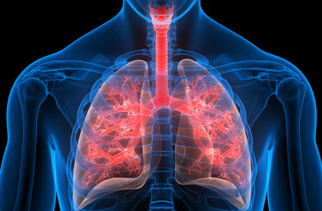 Lung Diseases: Leading Cause of Death