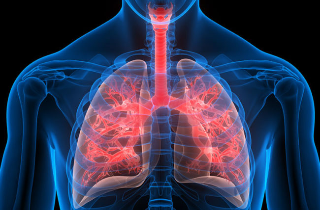 Lung Diseases: Leading Cause of Death