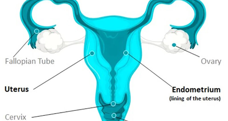 Gynaecological Malignancies