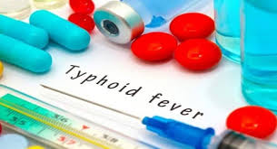 Typhoid