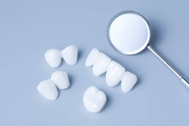 Dental implants with conscious sedation