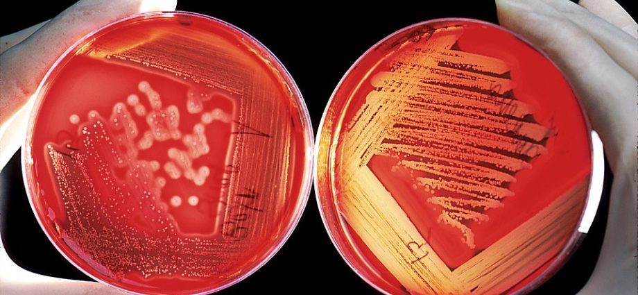 Blood Culture Test Market