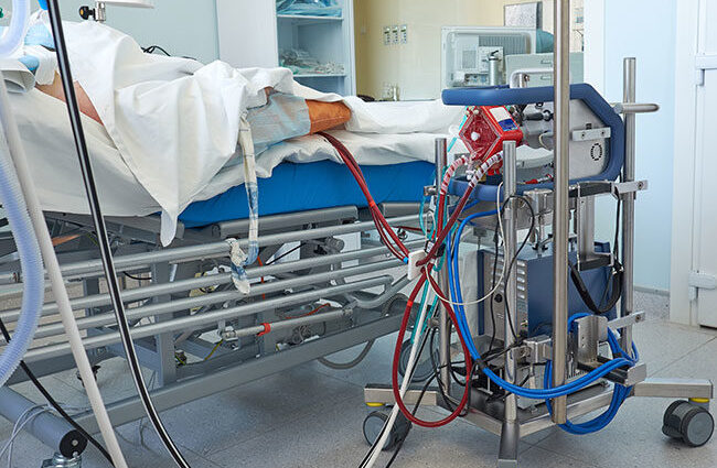 ecmo treatment