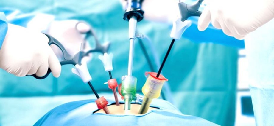 India Minimally Invasive Surgery Market