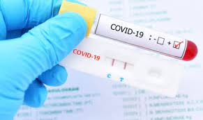 Xpress Urgent care provides a rapid PCR COVID-19 Test