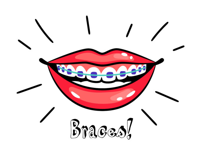 Braces Penang