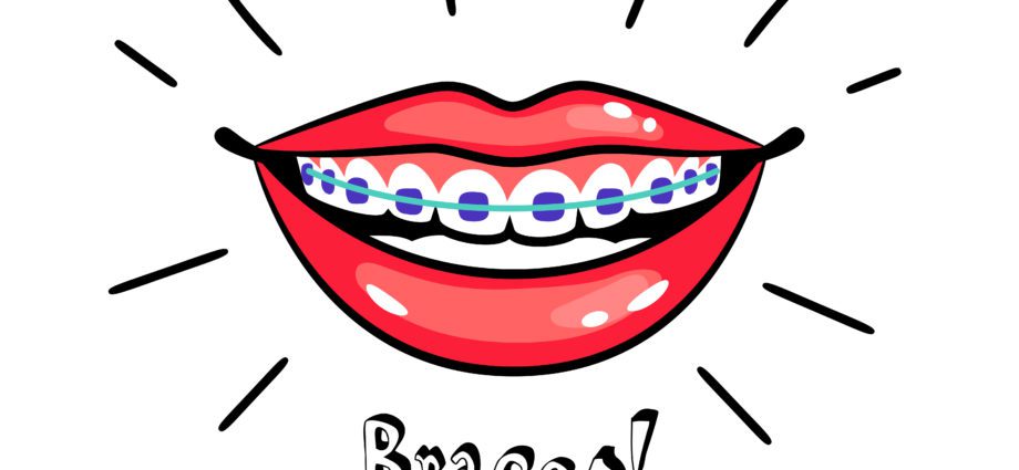 Braces Penang