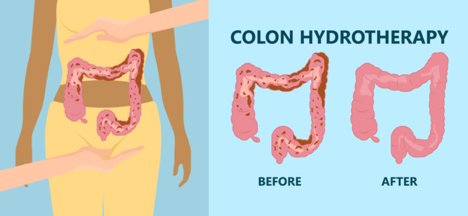 Colon Hydrotheropy