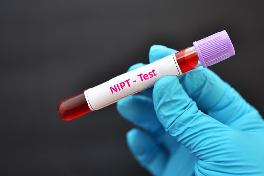 NIPT Tests