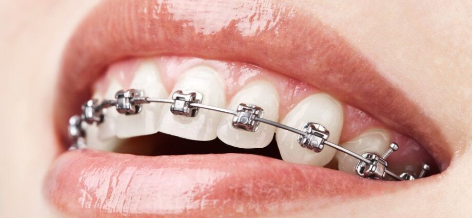 teen orthodontics