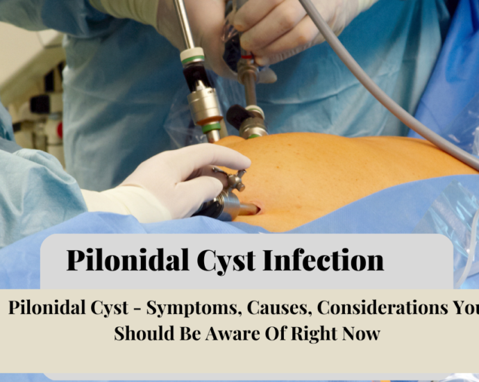 _Pilonidal Cyst Infection