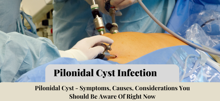 _Pilonidal Cyst Infection