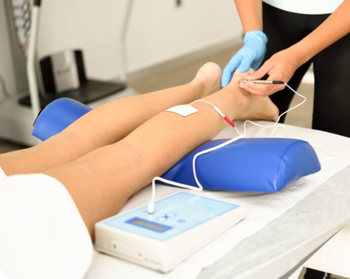 Vein Treatment